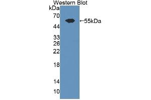 Western blot analysis of the recombinant protein. (ADAMTS13 antibody  (AA 896-1131))