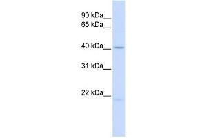 Ectodysplasin A antibody used at 1 ug/ml to detect target protein. (Ectodysplasin A anticorps  (Middle Region))