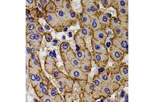 Immunohistochemical analysis of CCR5 staining in human liver formalin fixed paraffin embedded tissue section. (CCR5 antibody)