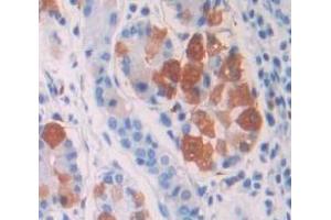 IHC-P analysis of Human Tissue, with DAB staining. (Gastrin antibody  (AA 1-101))