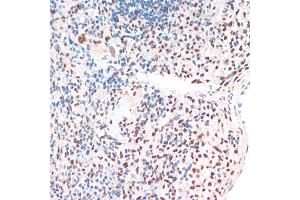 Immunohistochemistry of paraffin-embedded rat spleen using TDP-43/TARDB antibody (ABIN7270731) at dilution of 1:200 (40x lens). (TARDBP antibody  (AA 1-260))