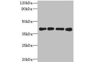 Western blot All lanes: MAGEB18 antibody at 12 μg/mL Lane 1: MCF-7 whole cell lysate Lane 2: A549 whole cell lysate Lane 3: Hela whole cell lysate Lane 4: Mouse heart tissue Secondary Goat polyclonal to rabbit IgG at 1/10000 dilution Predicted band size: 39 kDa Observed band size: 39 kDa (MAGEB18 antibody  (AA 1-270))