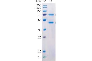 Human  M Protein, hFc Tag on SDS-PAGE under reducing condition. (MASP2 Protein (Fc Tag))