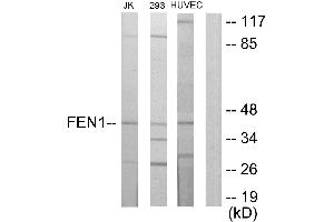 Immunohistochemistry analysis of paraffin-embedded human breast carcinoma tissue using FEN1 antibody. (FEN1 antibody)