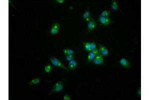 Immunofluorescence staining of SH-SY5Y cells with ABIN7167554 at 1:166, counter-stained with DAPI. (REG3A antibody  (AA 27-175))