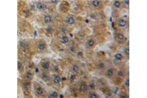 IHC-P analysis of Liver tissue, with DAB staining. (APOH antibody  (AA 22-345))