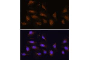 Immunofluorescence analysis of U-2 OS cells using RPS6K antibody (5718) at dilution of 1:100. (RPS6KA1 antibody  (C-Term))