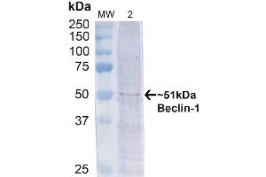 Western blot analysis of Human Cervical cancer cell line (HeLa) lysate showing detection of ~51 kDa Beclin 1 protein using Rabbit Anti-Beclin 1 Polyclonal Antibody (ABIN2868750). (Beclin 1 antibody  (Biotin))
