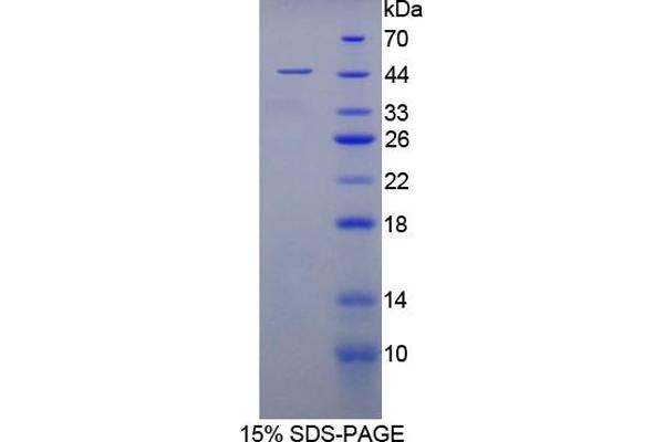 MSE Protein