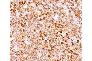 IHC testing of human tonsil (20X) stained with CD79a antibody cocktail (JCB117 + HM47/A9). (CD79a antibody  (AA 202-216))