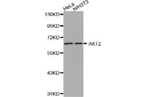 Western blot analysis of extracts of various cell lines, using AKT2 antibody (ABIN5970134). (AKT2 antibody)