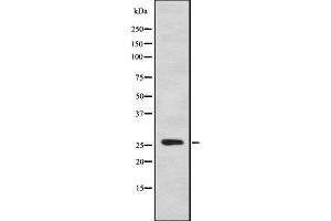 Western blot analysis of ASF1B using K562 whole cell lysates (ASF1B antibody  (Internal Region))