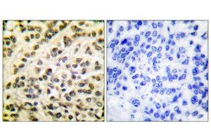 Immunohistochemistry (IHC) image for anti-Friend Leukemia Virus Integration 1 (FLI1) (Internal Region) antibody (ABIN1848551) (FLI1 antibody  (Internal Region))