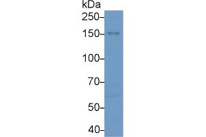 Western blot analysis of Human MCF7 cell lysate, using Human EPHA1 Antibody (2 µg/ml) and HRP-conjugated Goat Anti-Rabbit antibody ( (EPHA1 antibody  (AA 599-842))