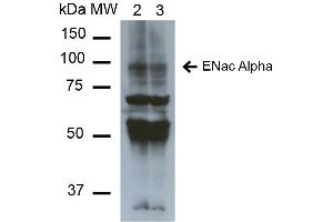 Western Blot analysis of Mouse Whole kidney homogenates showing detection of ~85kDa ENaC alpha protein using Mouse Anti-ENaC alpha Monoclonal Antibody, Clone 2G4 . (SCNN1A antibody  (AA 46-68) (APC))