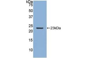 Detection of Recombinant MMP12, Rabbit using Polyclonal Antibody to Matrix Metalloproteinase 12 (MMP12) (MMP12 antibody  (AA 286-464))