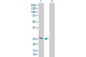 Lane 1: FOLR1 transfected lysate ( 28. (FOLR1 293T Cell Transient Overexpression Lysate(Denatured))