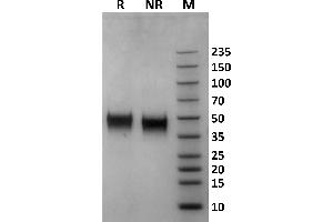 Human Fc gamma RIIIb / CD16b (NA1) protein on Coomassie Blue stained SDS-PAGE under non-reducing (NR) and reducing (R) conditions. (FCGR3B Protein (AA 17-200) (His-Avi Tag,Biotin))