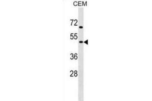 Western Blotting (WB) image for anti-Cholinergic Receptor, Nicotinic, gamma (CHRNG) antibody (ABIN2999214) (CHRNG antibody)