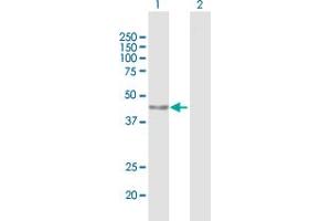 Western Blot analysis of PARP15 expression in transfected 293T cell line by PARP15 MaxPab polyclonal antibody. (PARP15 antibody  (AA 1-444))