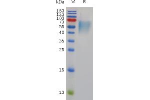 Mouse IL17RA Protein, His Tag on SDS-PAGE under reducing condition. (IL17RA Protein (AA 32-322) (His tag))