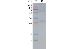 Human AD-Nanodisc, Flag Tag on SDS-PAGE (ADGRG1 Protein)