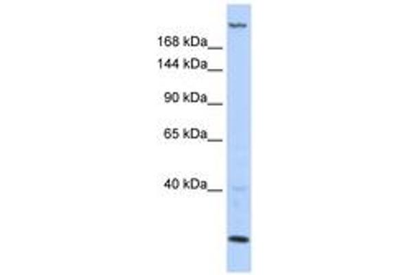 TNRC6B antibody  (AA 396-445)