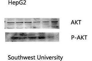 Western Blot (WB) analysis: Please contact us for more details. (AKT1 antibody  (Internal Region))