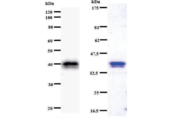 CHD1L antibody