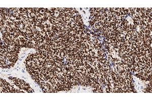 Immunohistochemistry (IHC) image for anti-NK2 Homeobox 1 (NKX2-1) (N-Term) antibody (ABIN7538942) (NKX2-1 antibody  (N-Term))