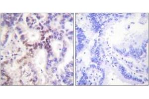 Immunohistochemistry (Paraffin-embedded Sections) (IHC (p)) image for anti-Cyclin-Dependent Kinase Inhibitor 2B (p15, Inhibits CDK4) (CDKN2B) (AA 89-138) antibody (ABIN2889241) (CDKN2B antibody  (AA 89-138))