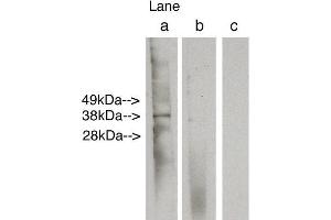 Western blot analysis using LAG1 longevity assurance homolog 6 . (CERS6 antibody)