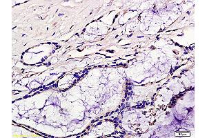 Immunohistochemistry (IHC) image for anti-Chemokine (C-C Motif) Receptor 7 (CCR7) (AA 25-59) antibody (ABIN674724)