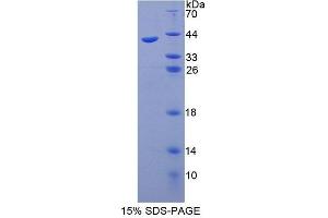 SDS-PAGE analysis of Human SYT1 Protein. (SYT1 Protein)