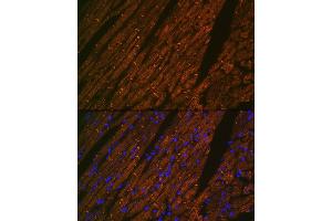 Immunofluorescence analysis of rat heart using Desmin Rabbit mAb (ABIN1678733, ABIN3018020, ABIN3018021 and ABIN7101569) at dilution of 1:100 (40x lens). (Desmin antibody)