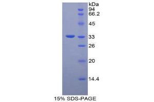 SDS-PAGE (SDS) image for Integrin beta 3 (ITGB3) (AA 134-376) protein (His tag) (ABIN2123840) (Integrin beta 3 Protein (ITGB3) (AA 134-376) (His tag))