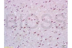 Formalin-fixed and paraffin embedded rat brain tissue labeled with Anti-Cathepsin B Polyclonal Antibody, Unconjugated (ABIN687412) at 1:200 followed by conjugation to the secondary antibody, (SP-0023), and DAB staining (Cathepsin B antibody  (AA 251-339))