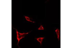 ABIN6266662 staining NIH-3T3 by IF/ICC. (TIMP4 antibody  (C-Term))