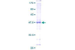 Image no. 1 for Ral GTPase Activating Protein, alpha Subunit 2 (Catalytic) (RALGAPA2) (AA 1-237) protein (GST tag) (ABIN1317347) (RALGAPA2 Protein (AA 1-237) (GST tag))