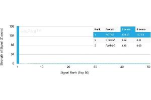 Analysis of Protein Array containing more than 19,000 full-length human proteins using Sarcomeric Actinin Alpha 2 Mouse Monoclonal Antibody (ACTN2/3294). (ACTN2 antibody  (AA 557-692))