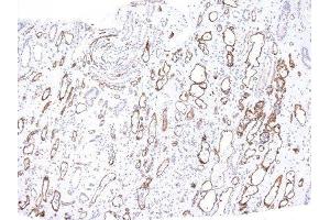 Image no. 2 for anti-Complement Component C4d (C4d) antibody (ABIN6173841) (Complement C4d antibody)