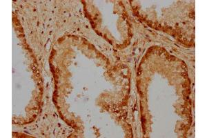 IHC image of nbutHU diluted at 1:20 and staining in paraffin-embedded human prostate cancer performed on a Leica BondTM system. (HIST1H4A antibody  (AA 28-39))