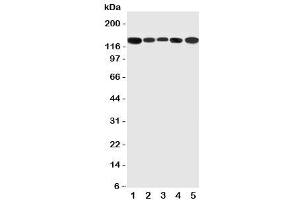 Western blot testing of RGS3 antibody and Lane 1:  rat testis (RGS3 antibody  (C-Term))