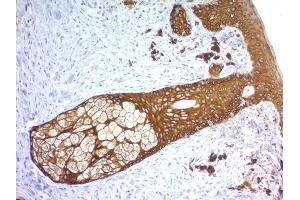 Formalin-fixed, paraffin-embedded human Skin stained with Cytokeratin, HMW Rabbit Recombinant Monoclonal Antibody (KRTH/1576R). (Recombinant Cytokeratin 2 antibody)