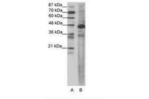 Image no. 1 for anti-Serum Response Factor (SRF) (AA 120-169) antibody (ABIN202686) (SRF antibody  (AA 120-169))