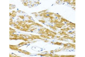 Immunohistochemistry of paraffin-embedded Mouse heart using MS4A8B Polyclonal Antibody at dilution of 1:100 (40x lens). (Membrane-Spanning 4-Domains, Subfamily A, Member 8 (MS4A8) antibody)