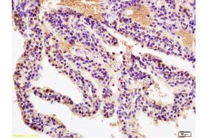 Immunohistochemistry (IHC) image for anti-CD33 (CD33) (AA 101-200) antibody (ABIN687607)