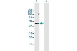Western Blot analysis of MMP28 expression in transfected 293T cell line by MMP28 MaxPab polyclonal antibody. (MMP28 antibody  (AA 1-393))