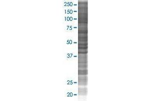 BEND2 transfected lysate. (CXorf20 293T Cell Transient Overexpression Lysate(Denatured))