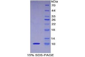 SDS-PAGE analysis of Human PKIa Protein. (PKIA Protéine)